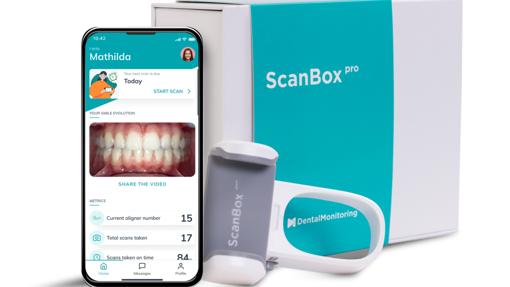 Scanbox Pro met App