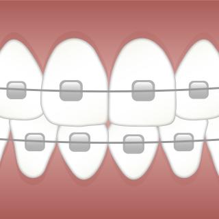 Braces 3597591 1920