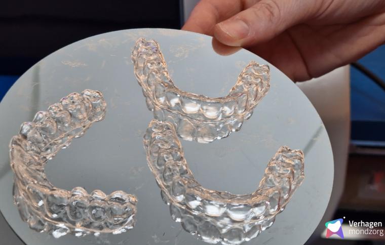 Graphy Aligners met watermerk 9